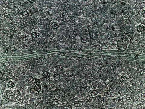 English: 105 Amelenchia LEAF epidermis print