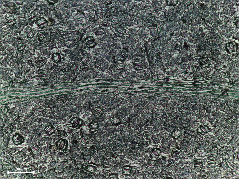 English: 105 Amelenchia LEAF epidermis print